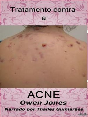 cover image of Tratamento Contra a Acne